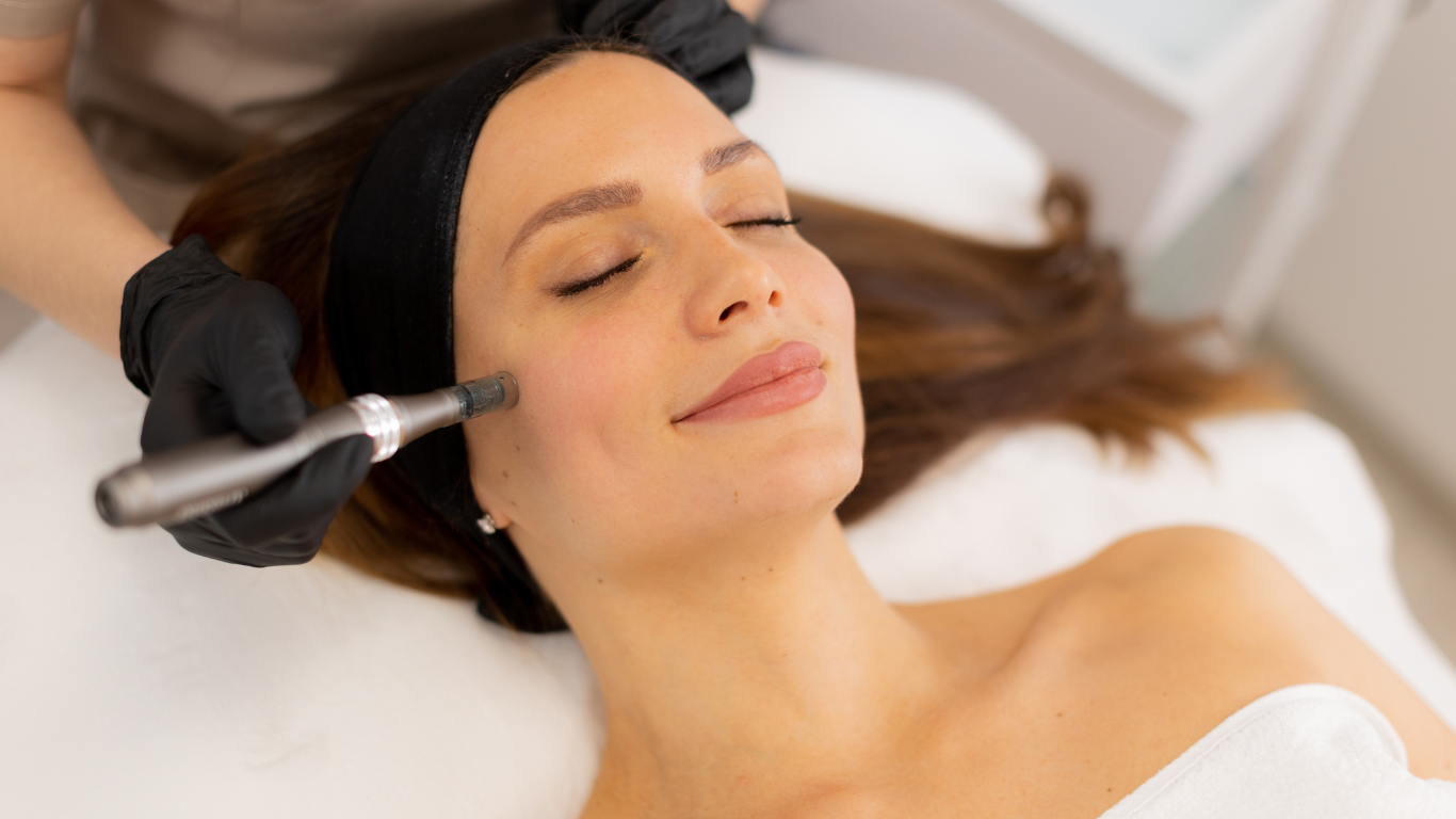 Fort Wayne Microneedling by The Red Stiletto