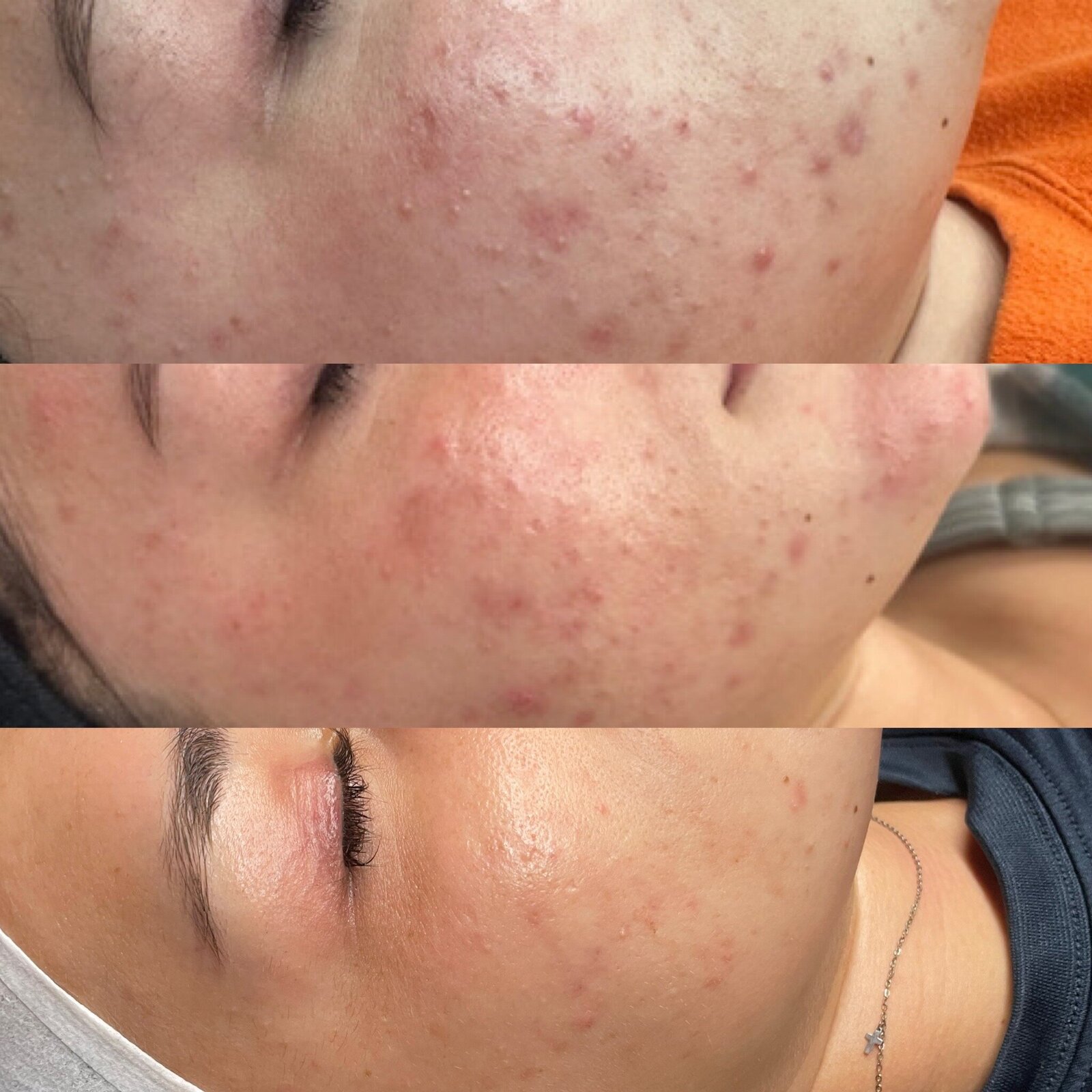 ABFA137D-4B71-4401-B5FF-1990C2DED7EC_L0_001-8_3_2024, 12_40_06 PM