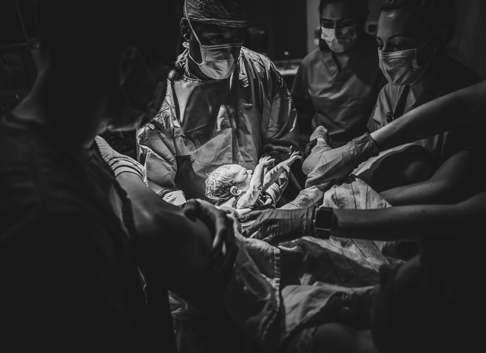 baby being born in hospital