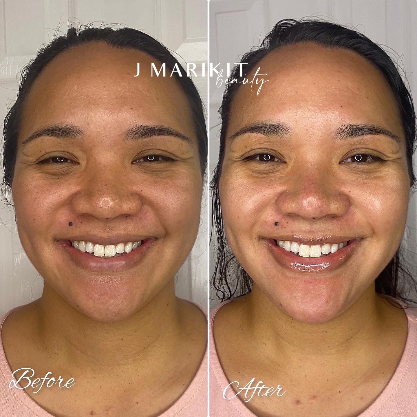This before and after image shows the results of Oahu's top beauty salon facials. Honolulu Area.