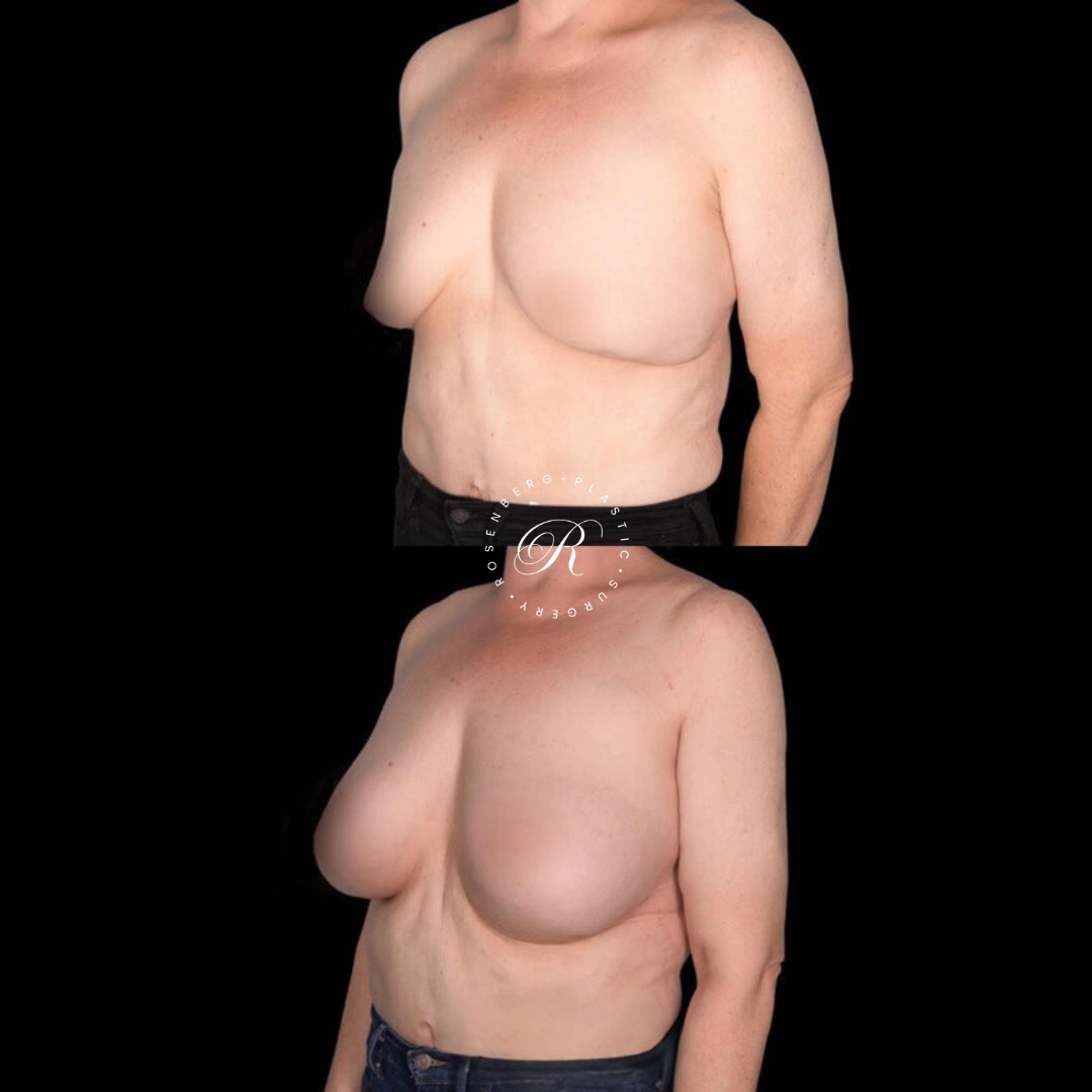 Copy of Copy of Template for Rosenberg Plastic Surgery B 2.png