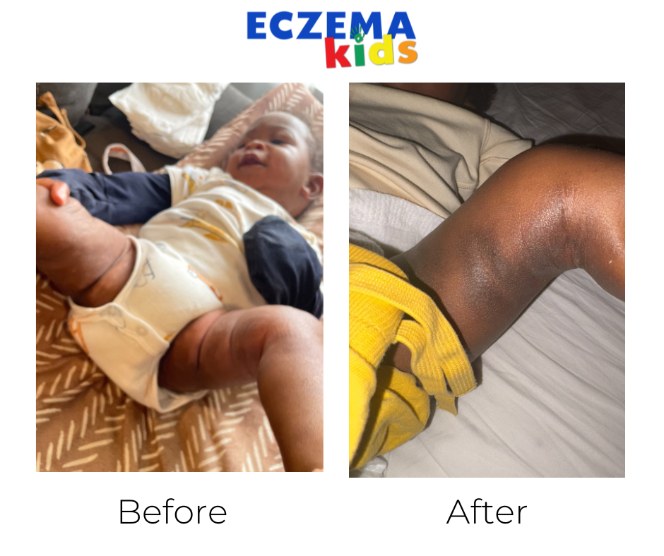 Micha before and after
