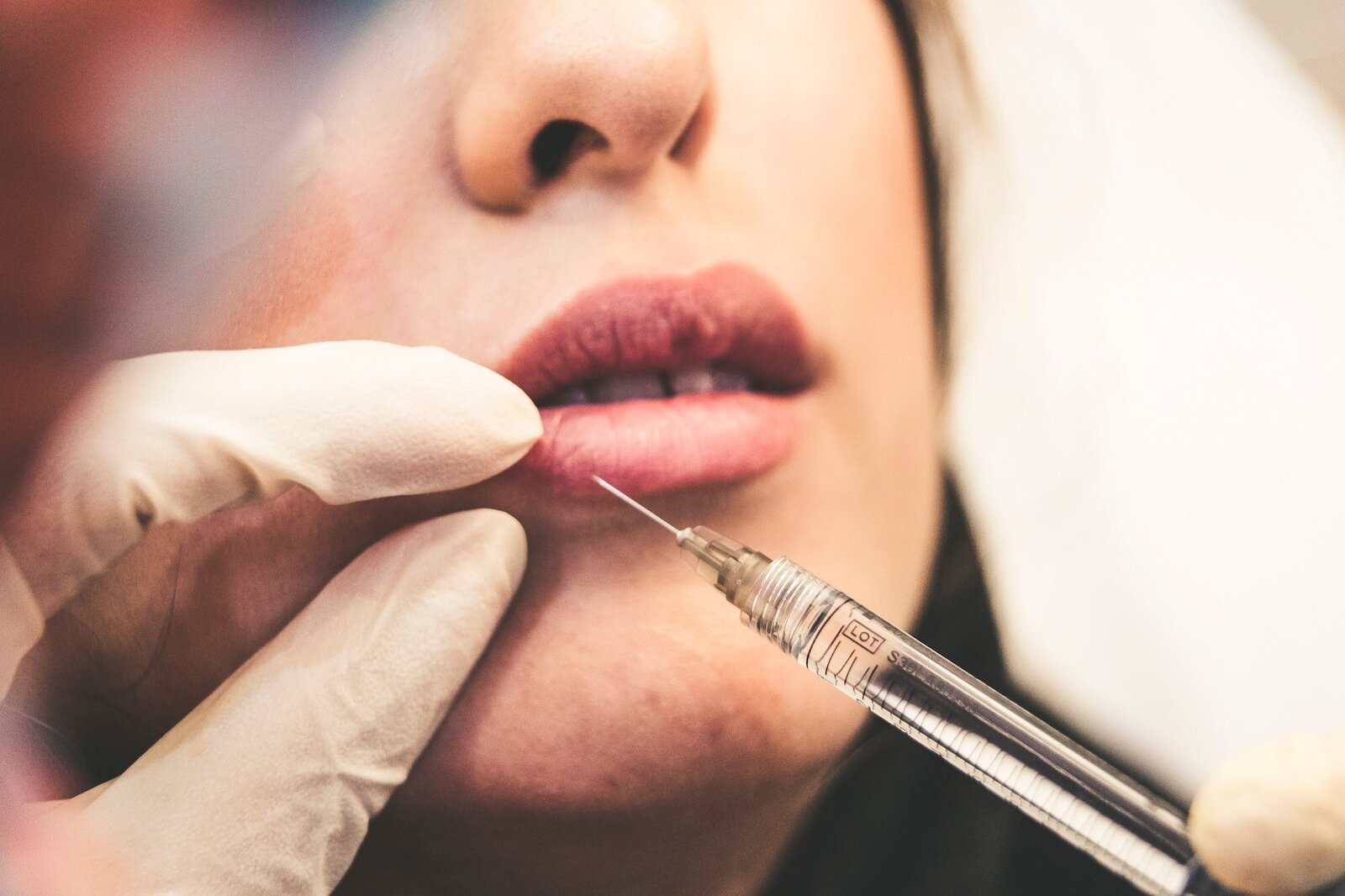 woman receiving lip filler