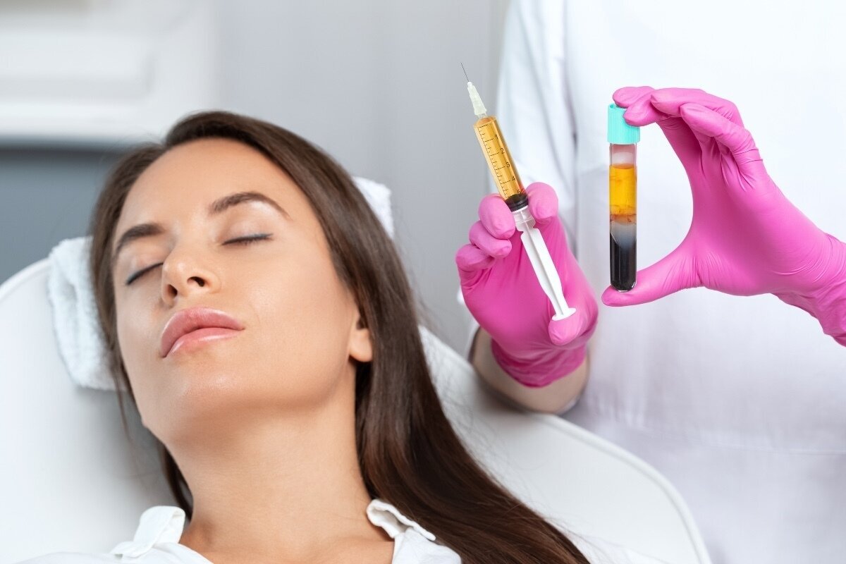 Platelet-Rich fibrin treatment on a woman