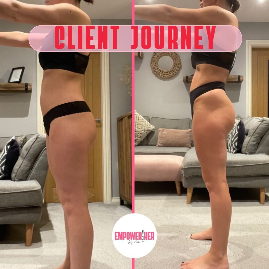 Sophie transformation - 3 months