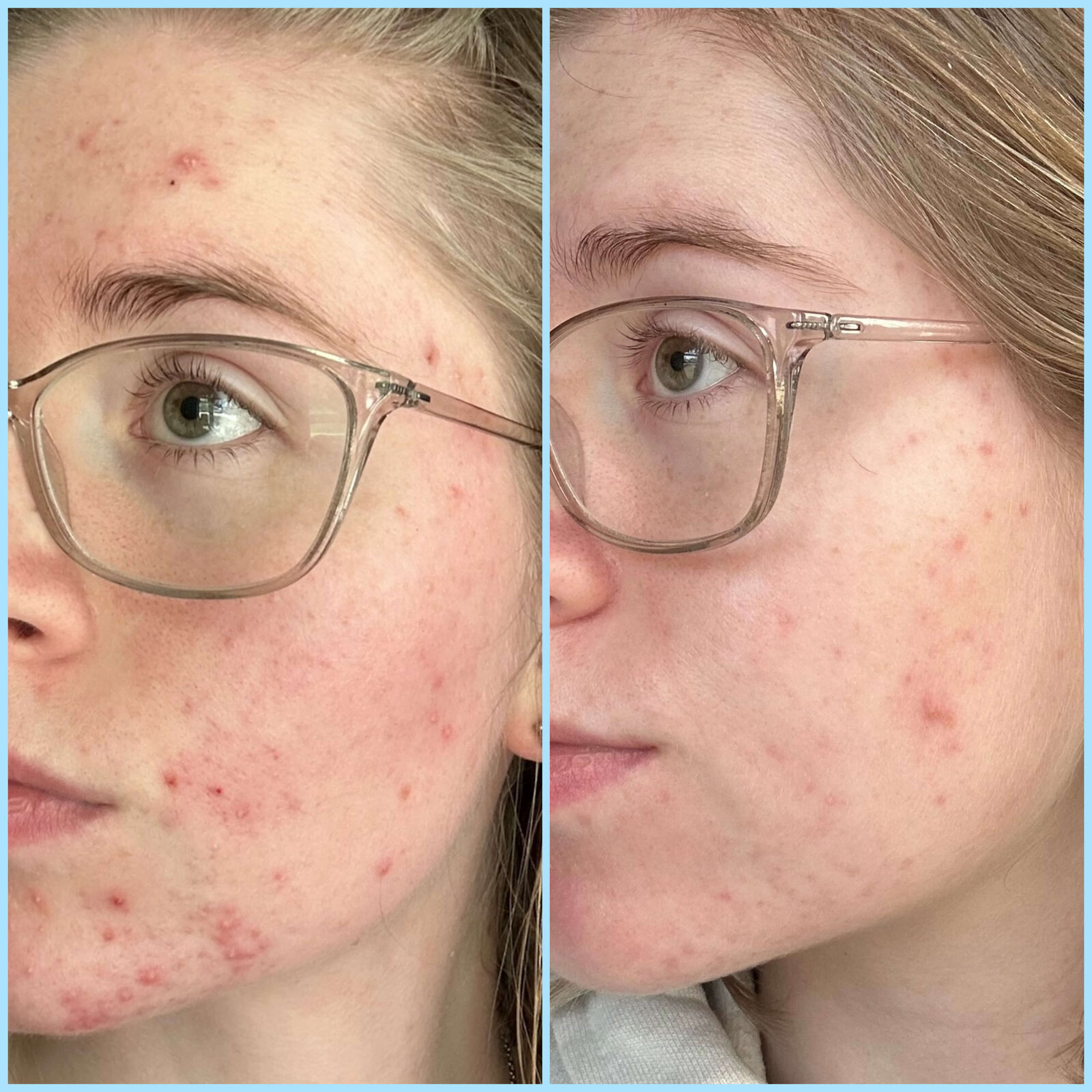 61D82C34-60DA-4A8D-9E6A-753222A47054