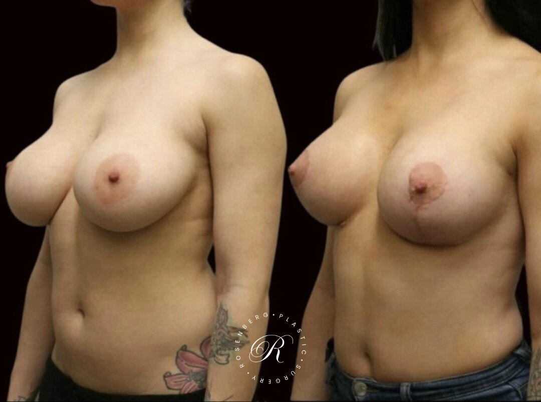 Copy of Copy of Template for Rosenberg Plastic Surgery B 5.png