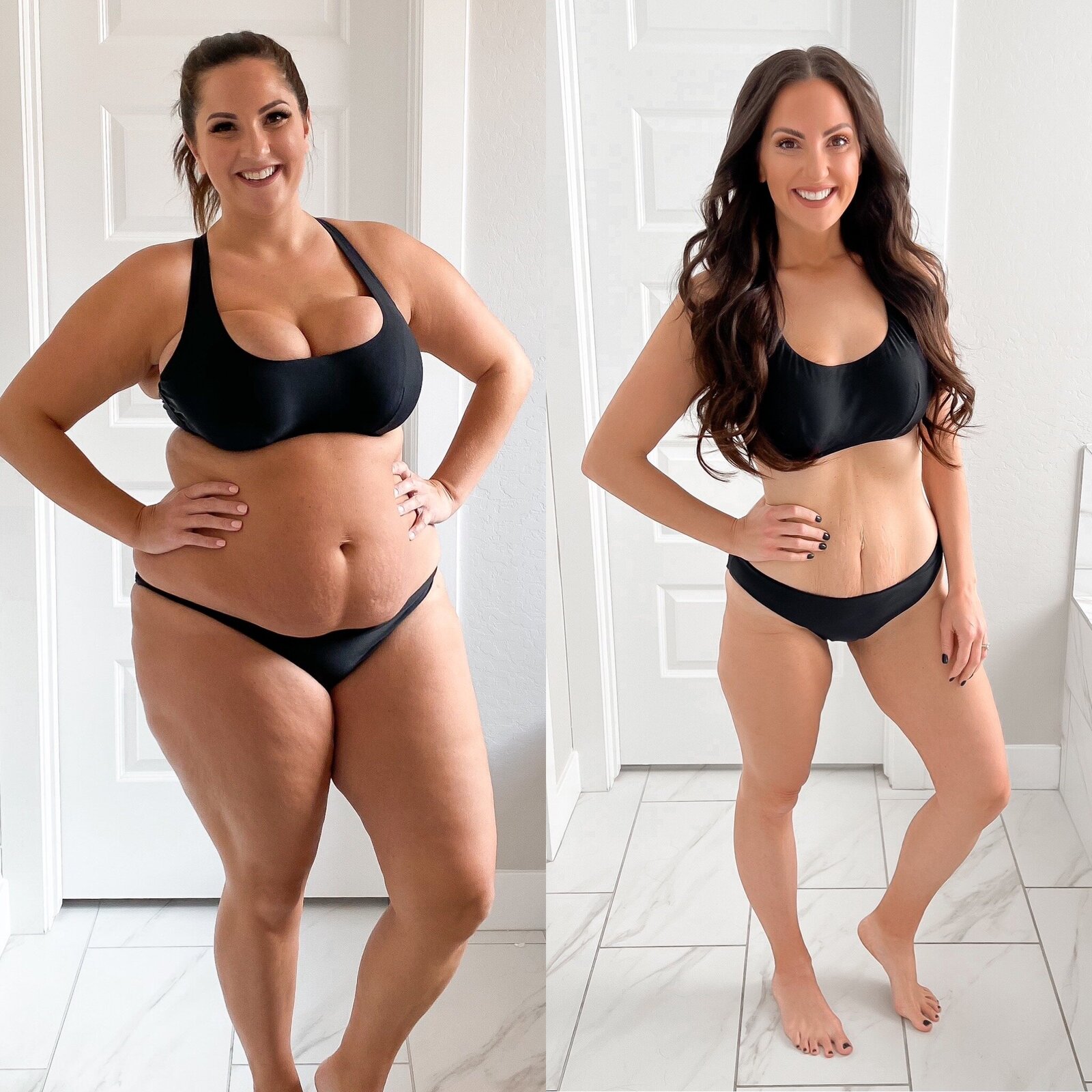 before-after-weight-loss-body-confidence3