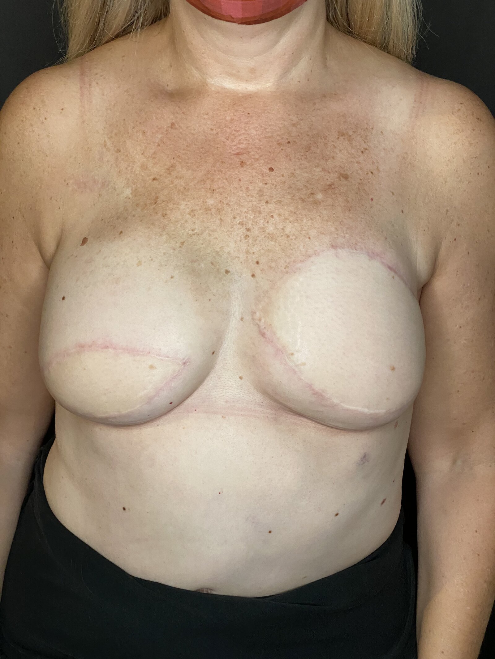 nipple tattoos - tattoo shops charlotte nc