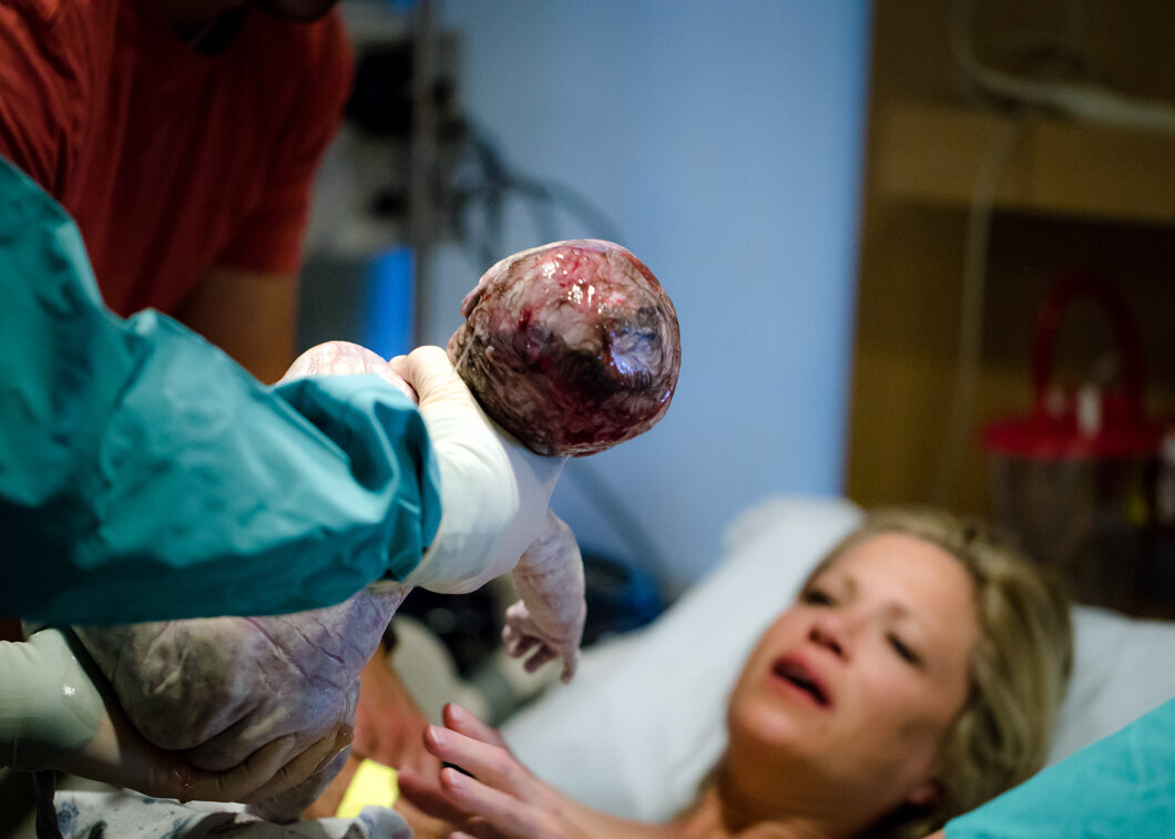 A brand new baby meets him mother for the first time.