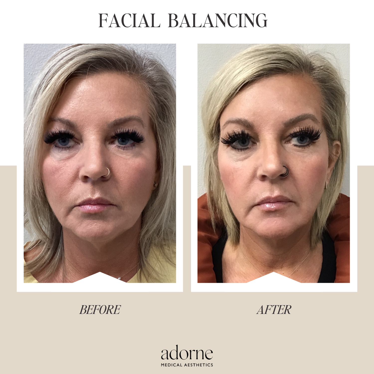 FULL FACE (14)