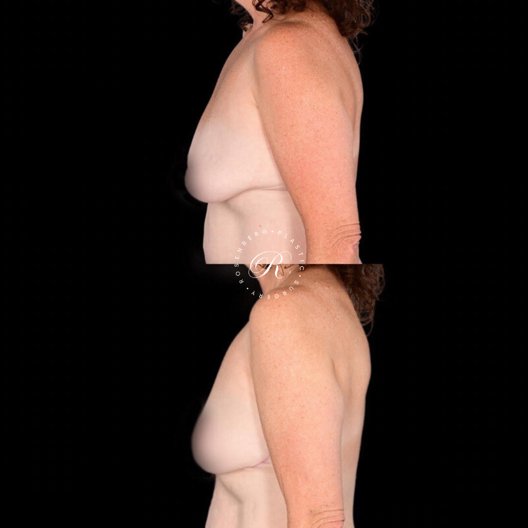 Copy of Template for Rosenberg Plastic Surgery B.zip - 11