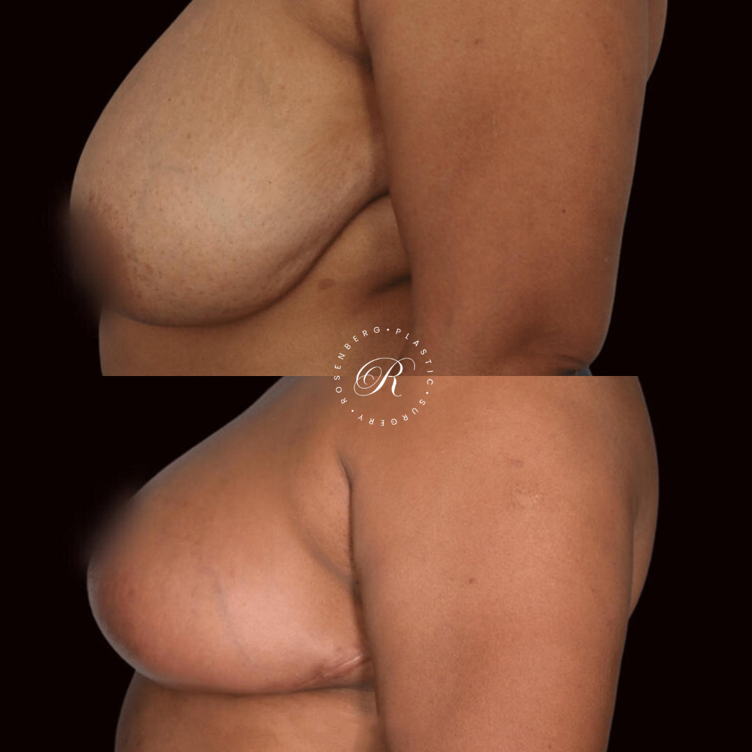 Copy of Template for Rosenberg Plastic Surgery B.zip - 24