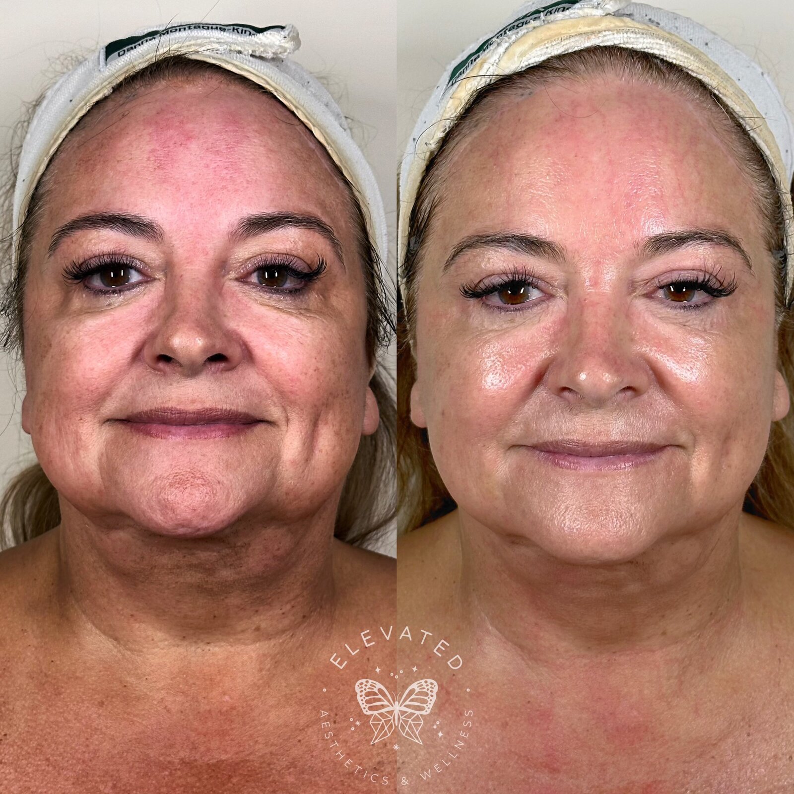 Facetune_30-05-2024-15-03-26