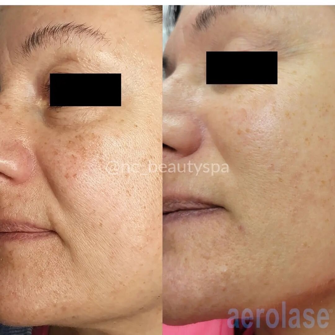 nc_beautyspa-1
