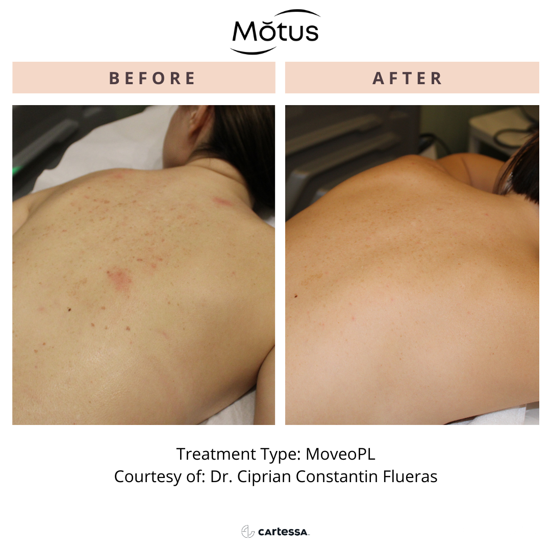 Motus11168970869386