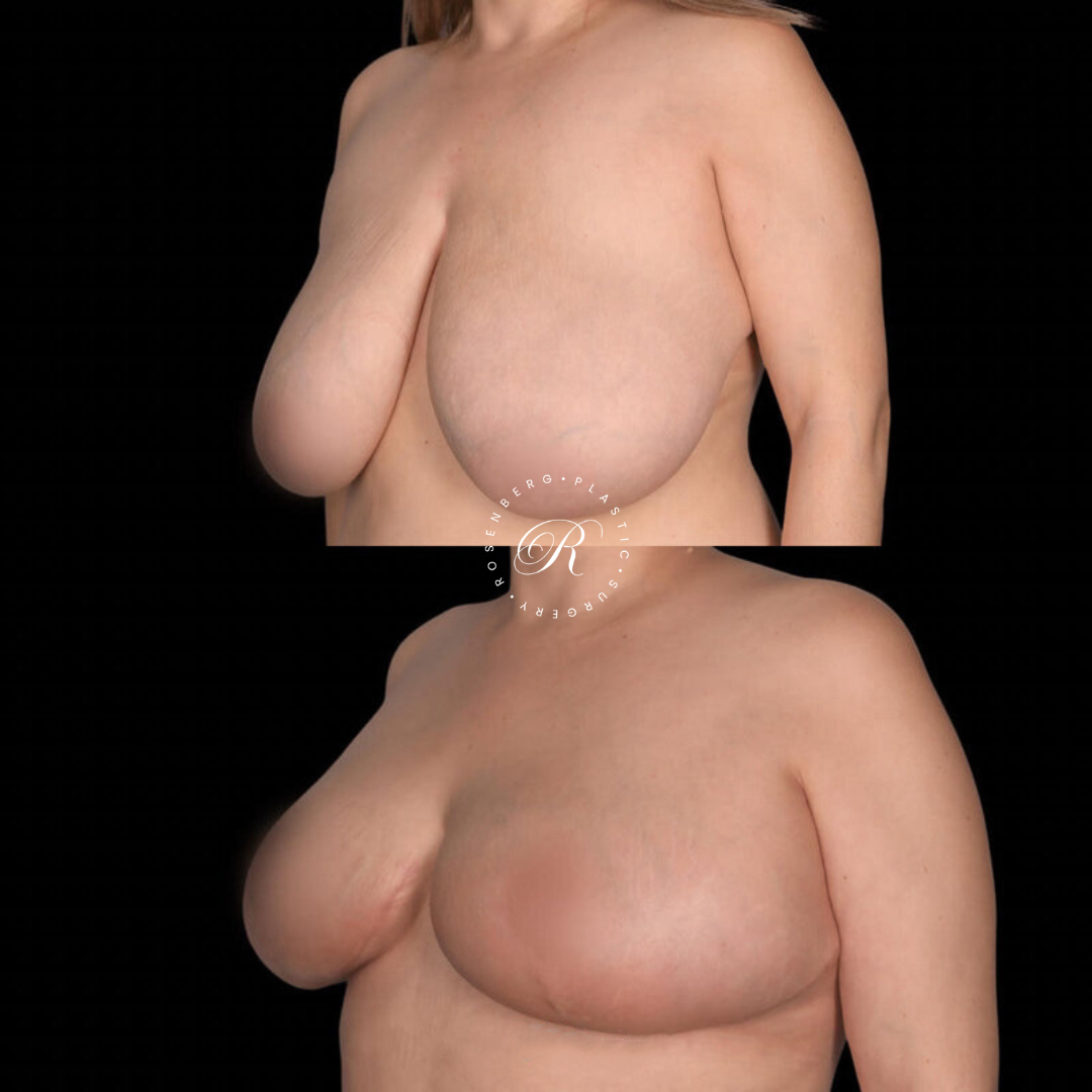 Copy of Template for Rosenberg Plastic Surgery B.zip - 23