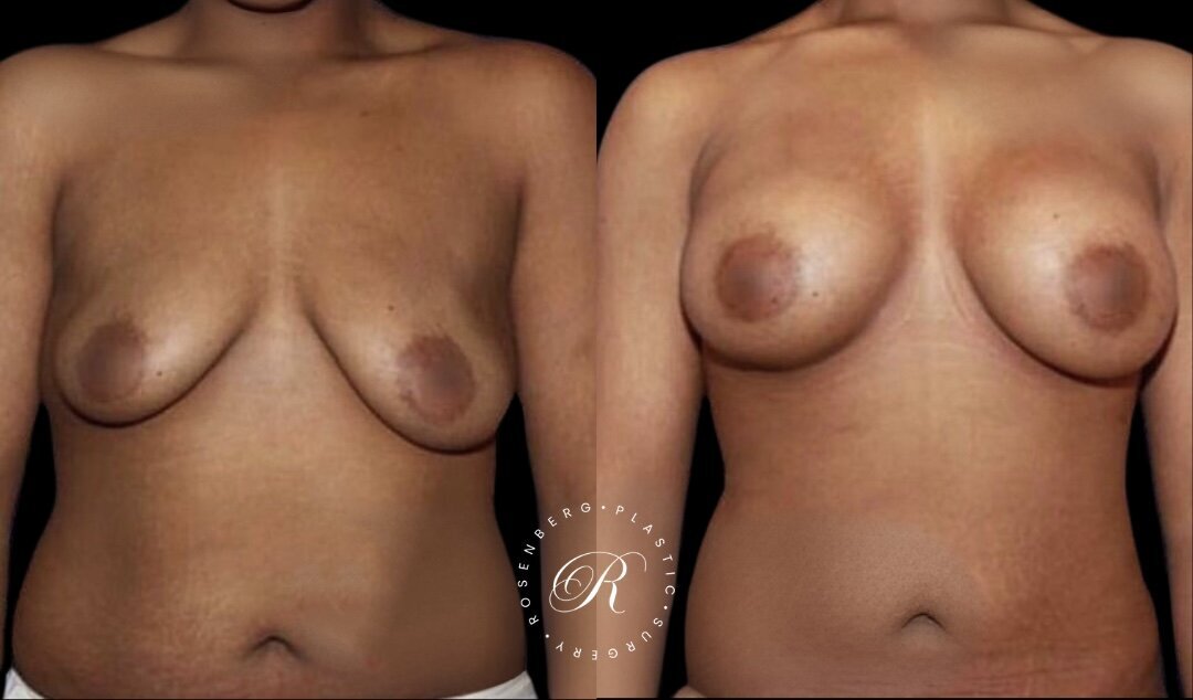 Copy of Copy of Template for Rosenberg Plastic Surgery B 2.png