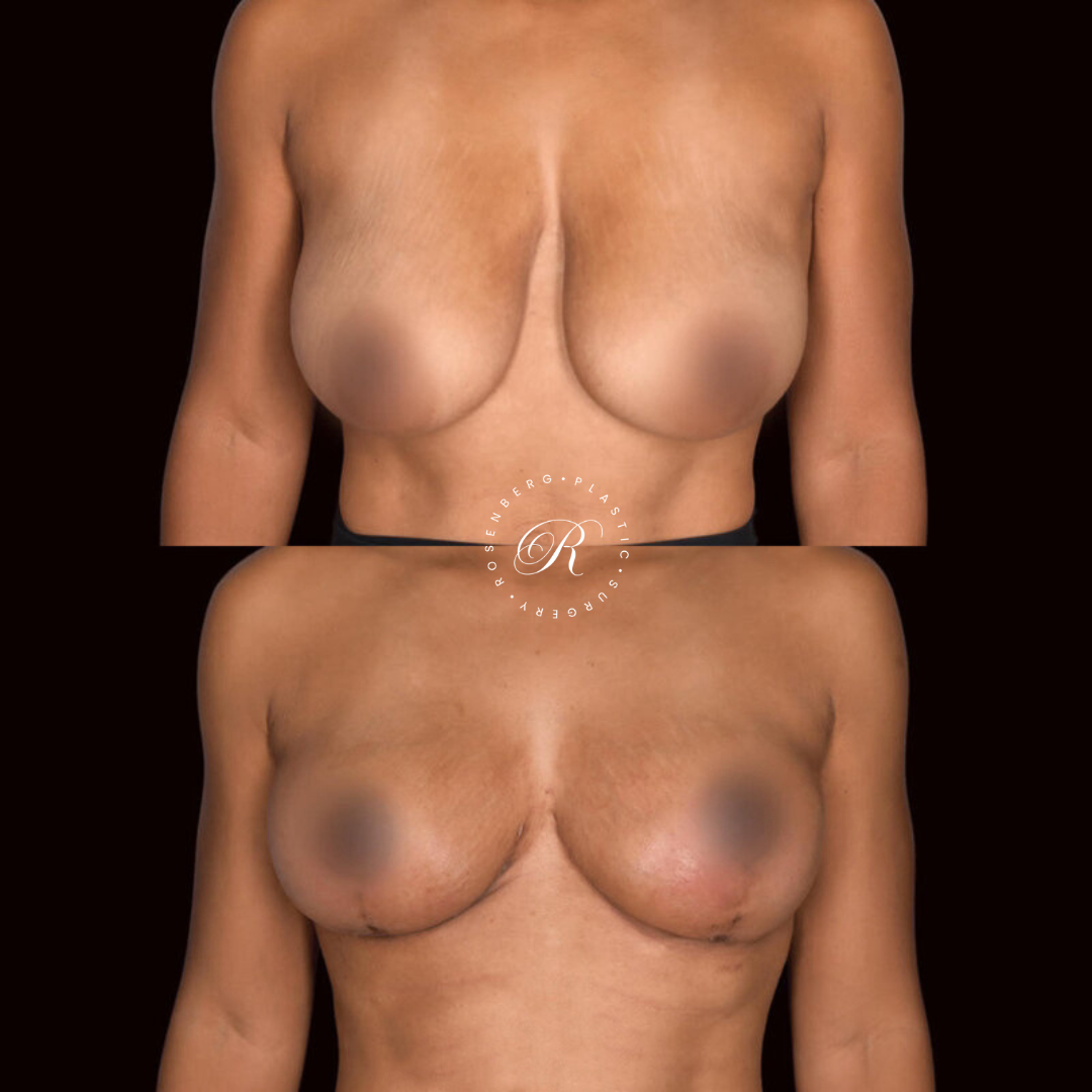 Copy of Template for Rosenberg Plastic Surgery B.zip - 8