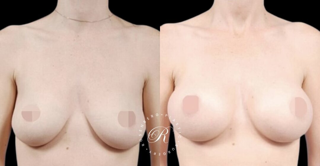 Copy of Copy of Template for Rosenberg Plastic Surgery B.png