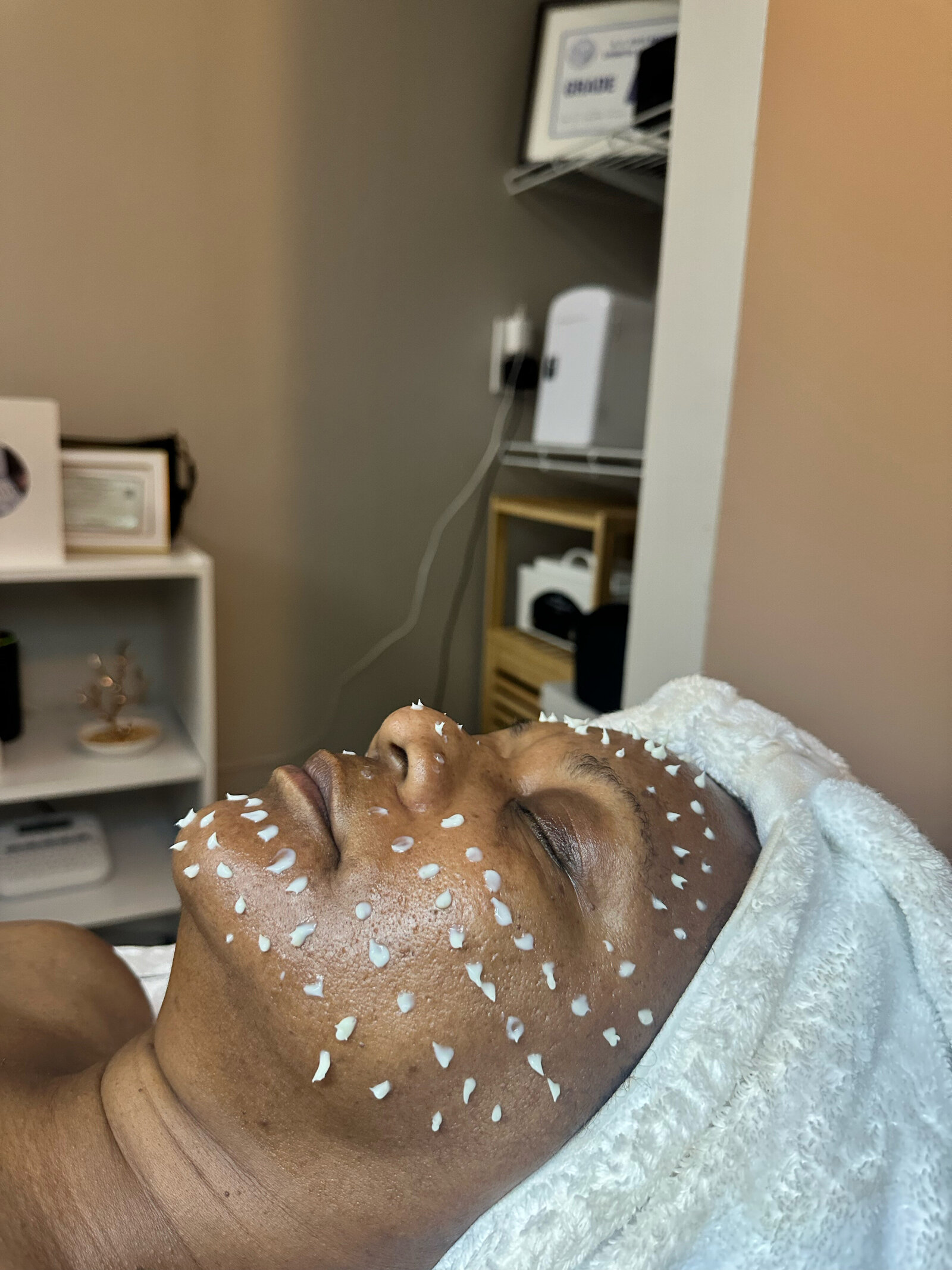 CellStory Treatment