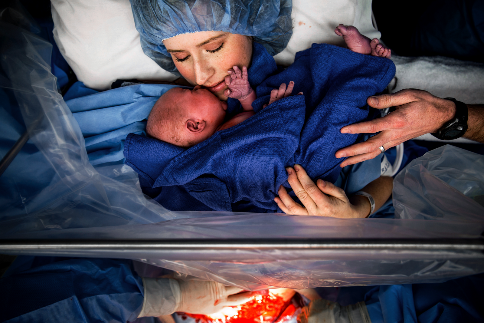 birth photographer, columbus, ga, atlanta, c-section, cesarean, mother and newborn, skin to skin, operating room