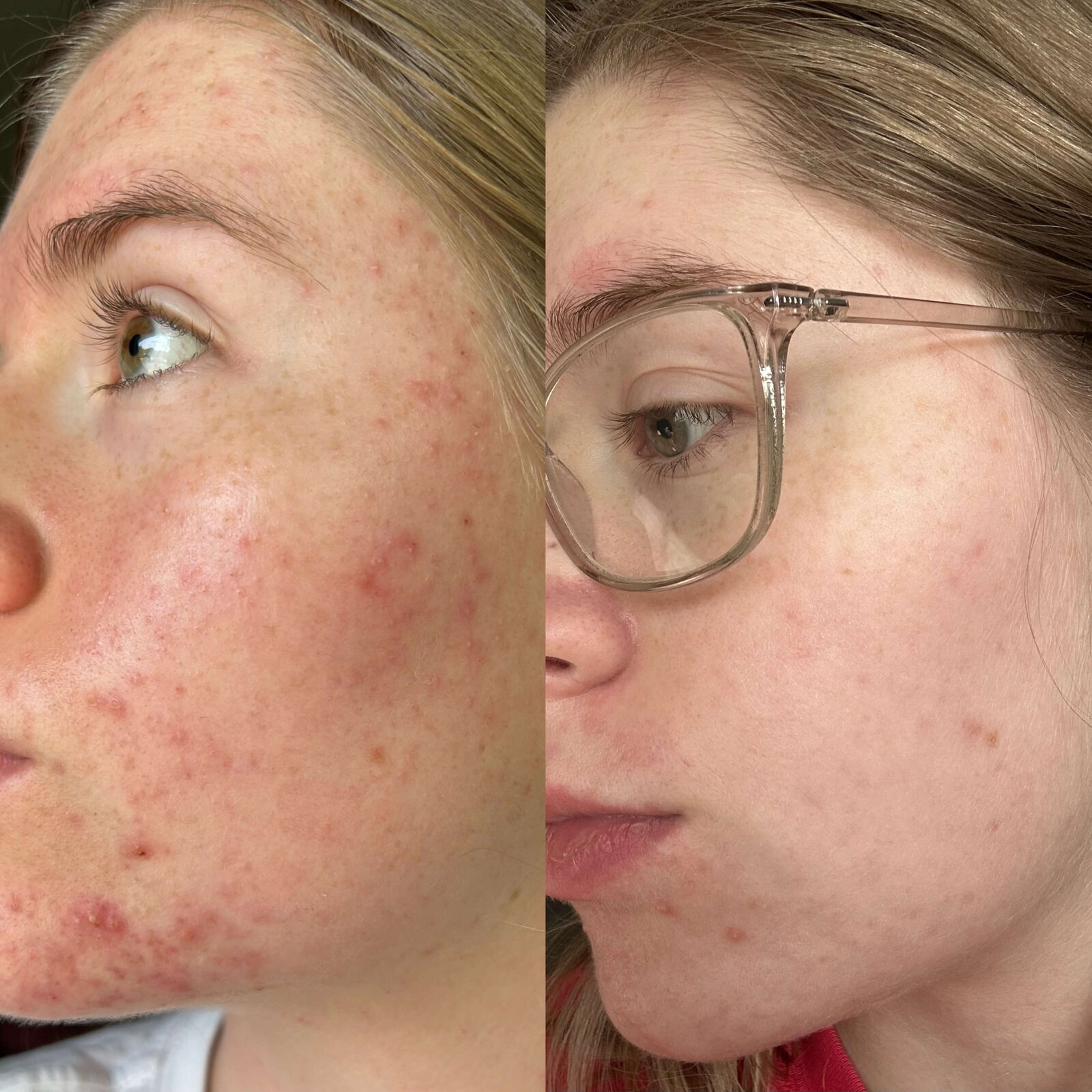 0B7563FD-4C83-4EB8-8519-41A044FEB163