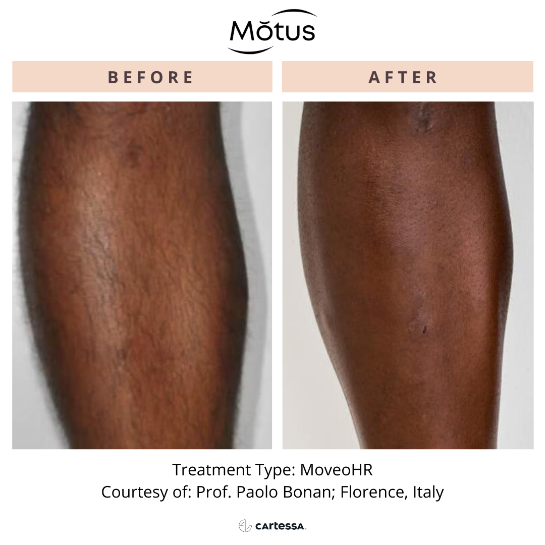Motus1168970869299