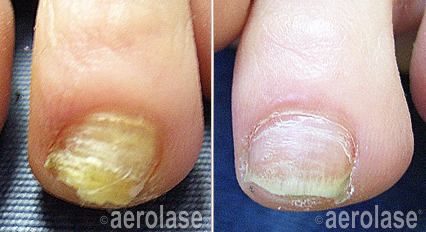 Nails - Lisa Hochman, MD