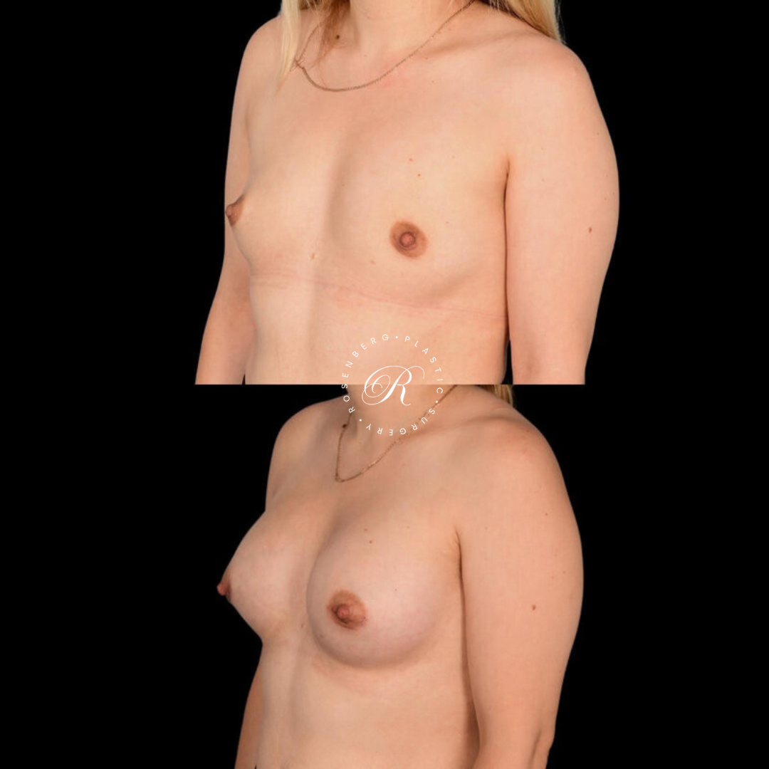 Copy of Copy of Template for Rosenberg Plastic Surgery B 5.png