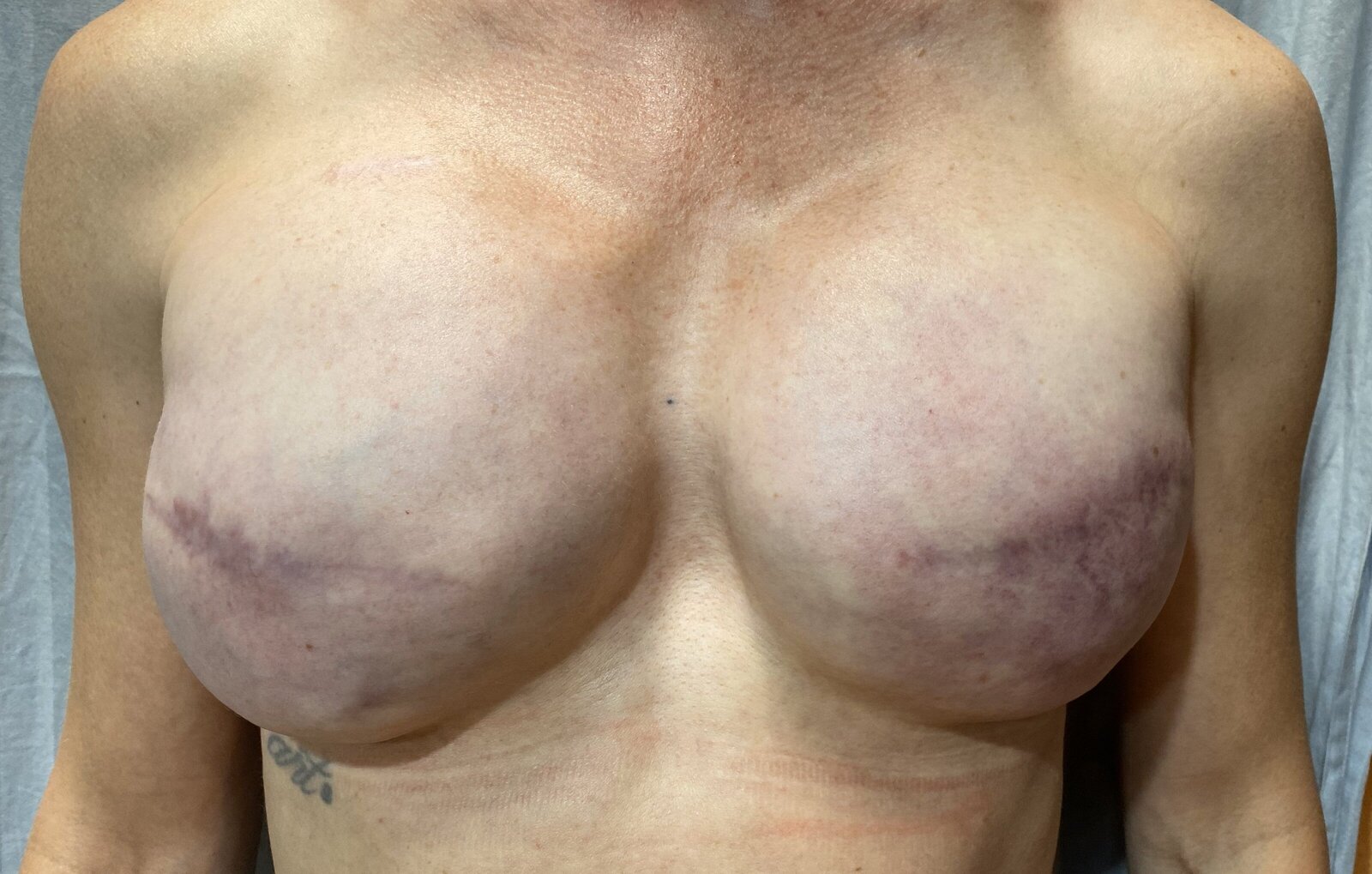 TM 1 nipple tattoo_nipple tattoos_tattoo shops charlotte nc