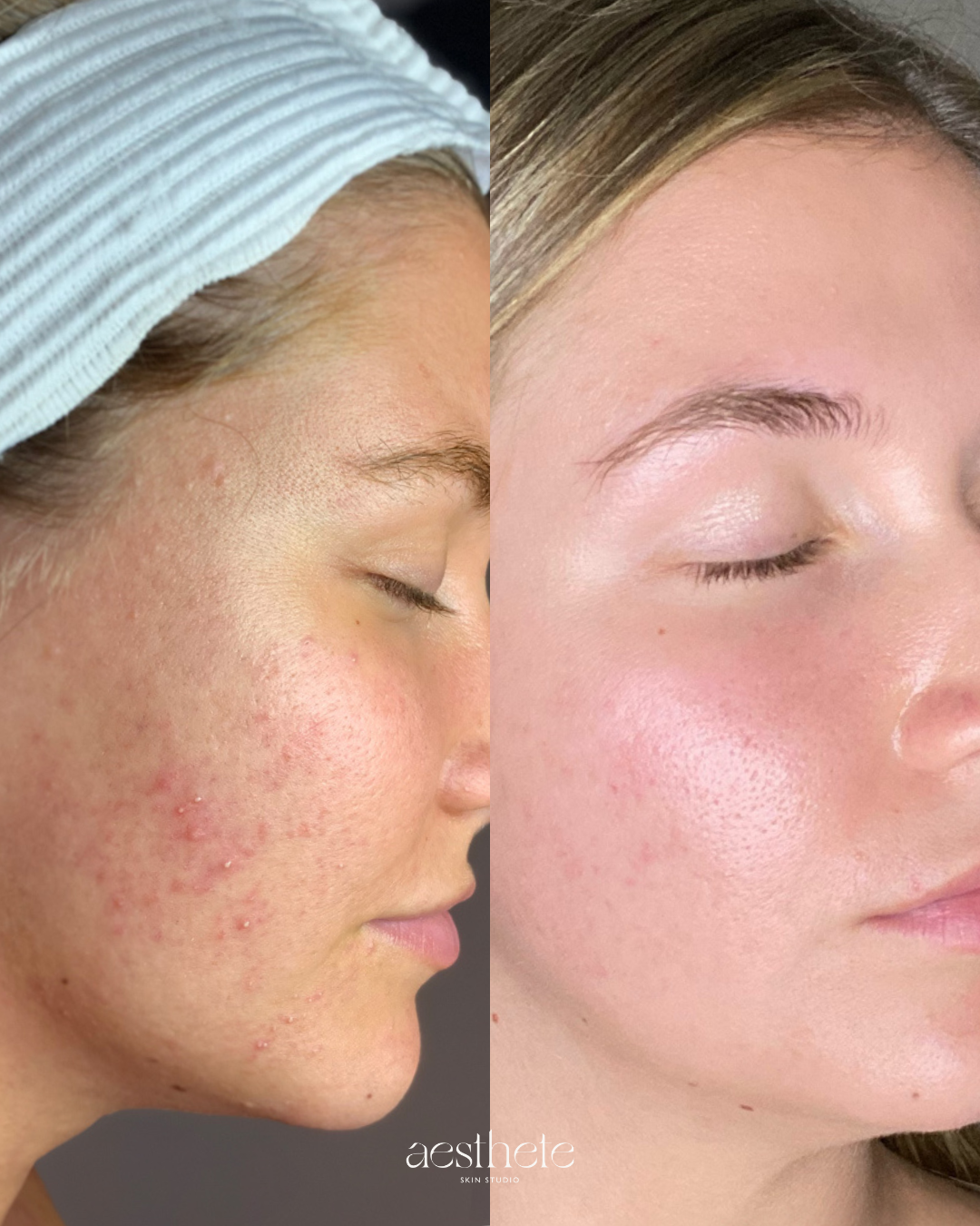 WEEK 4 FRIDAY (4)