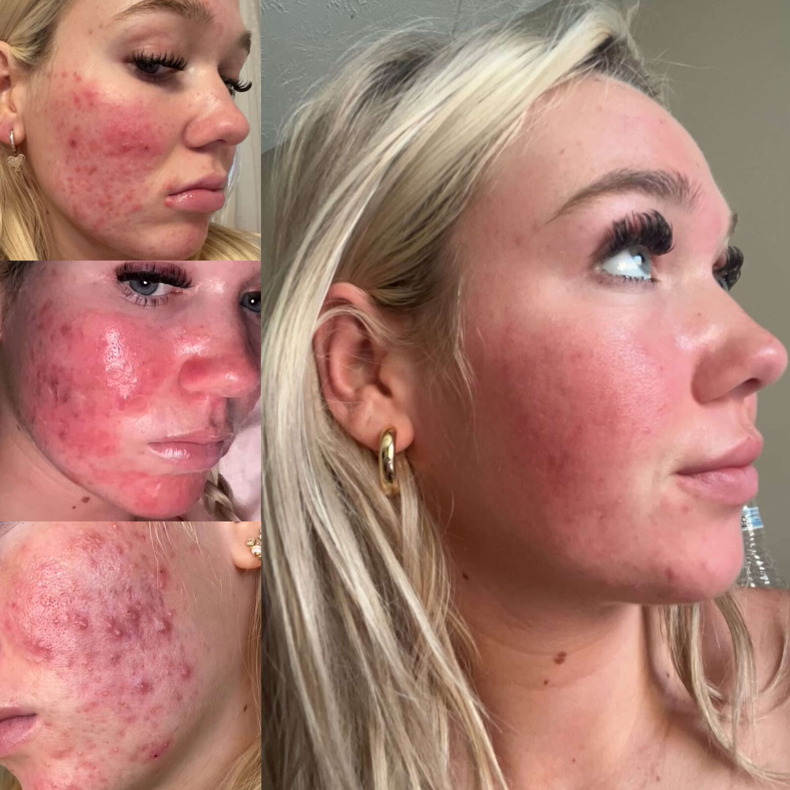 4E0D8B2C-9EAA-42C4-BE27-C5C7F6AC24A0