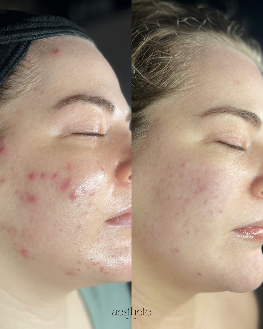 WEEK 3 FRIDAY (2)