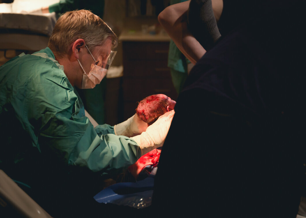 A doctor delivers a baby's head during a Utah Birth Story.
