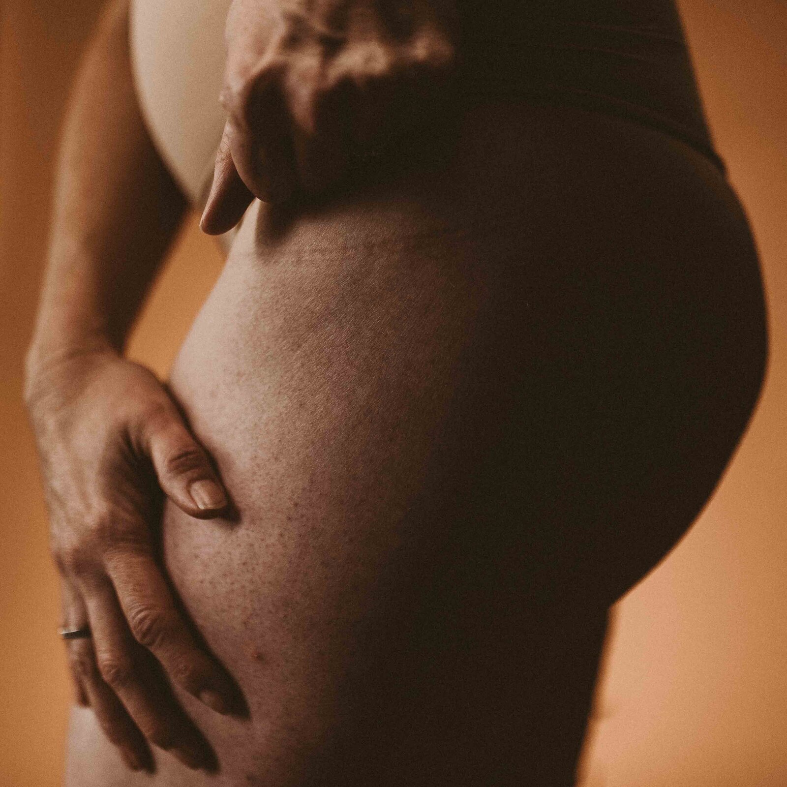 woman pointing a scar on her thigh