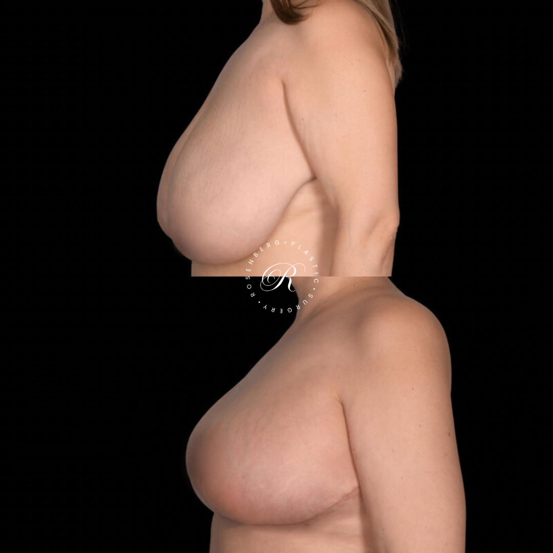 Copy of Template for Rosenberg Plastic Surgery B.zip - 21