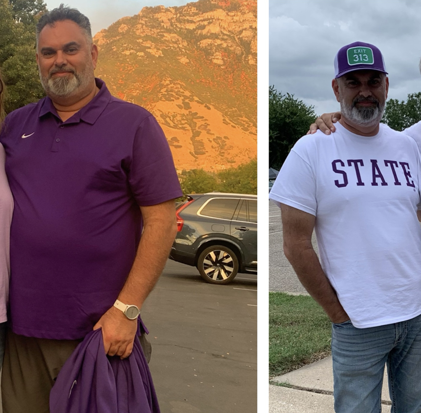 Before and after - Hayes St Med Spa Medical Weight Loss