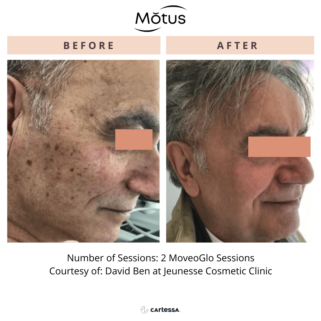 MotusAZ5168970930598