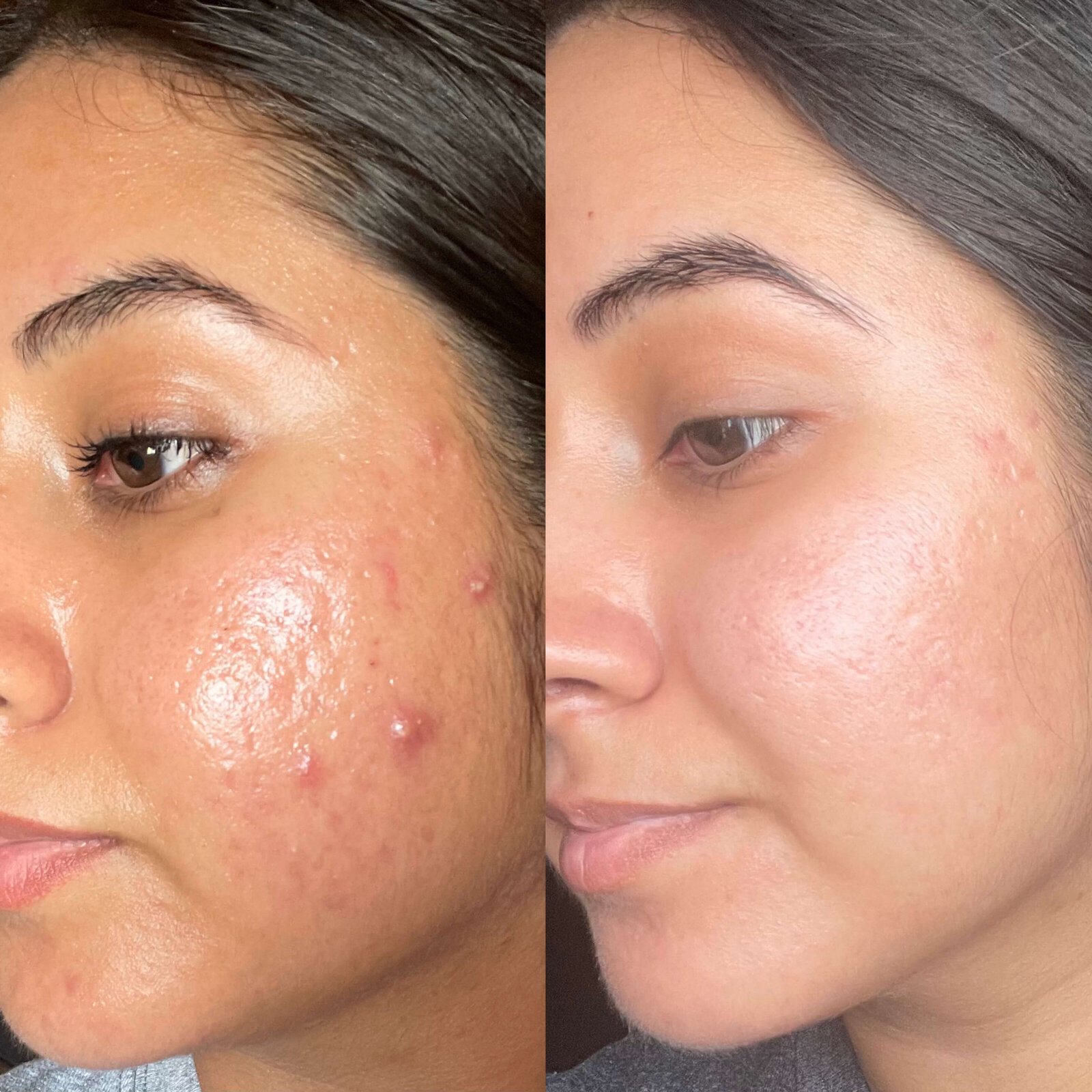 53EAA31D-17E4-403C-9D2C-CAAECABAF43F