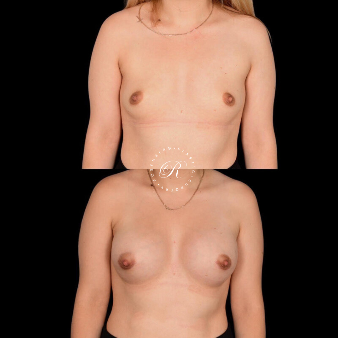 Copy of Copy of Template for Rosenberg Plastic Surgery B 3.png