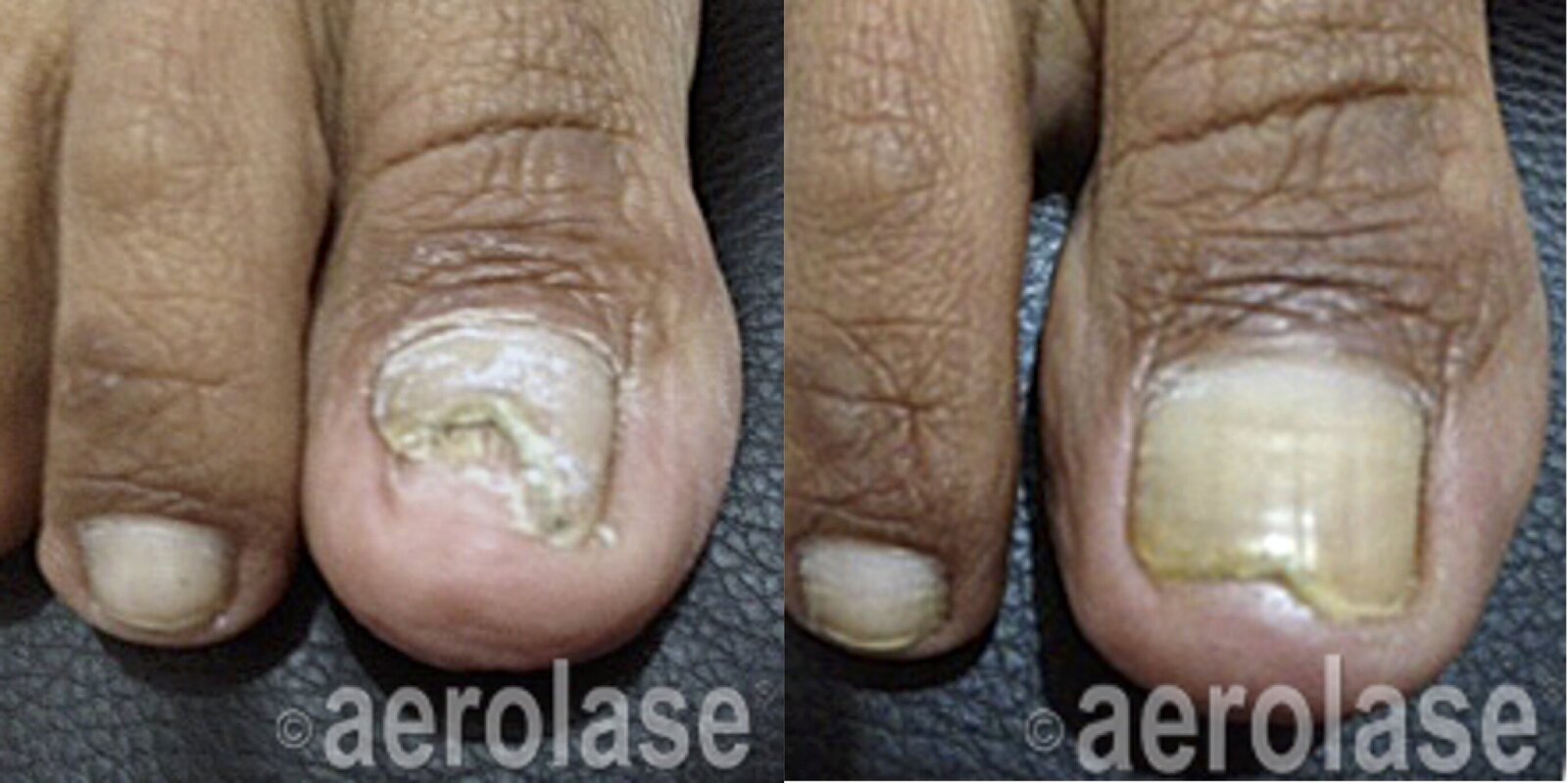 Nails - Dr. Raj Kumar