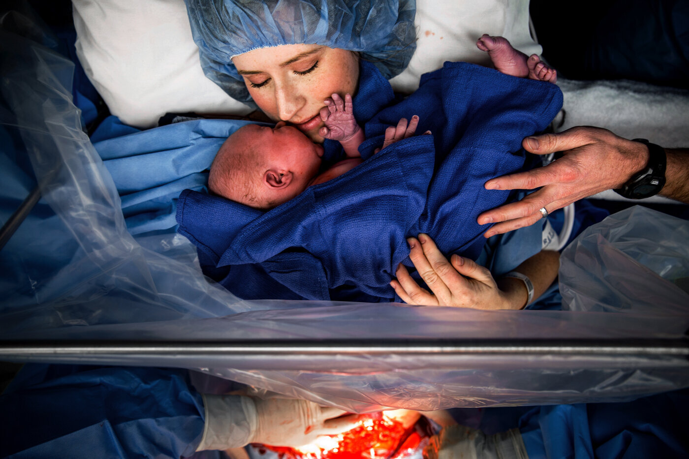 birth photographer, columbus, ga, atlanta, c-section, cesarean, clear drape 2