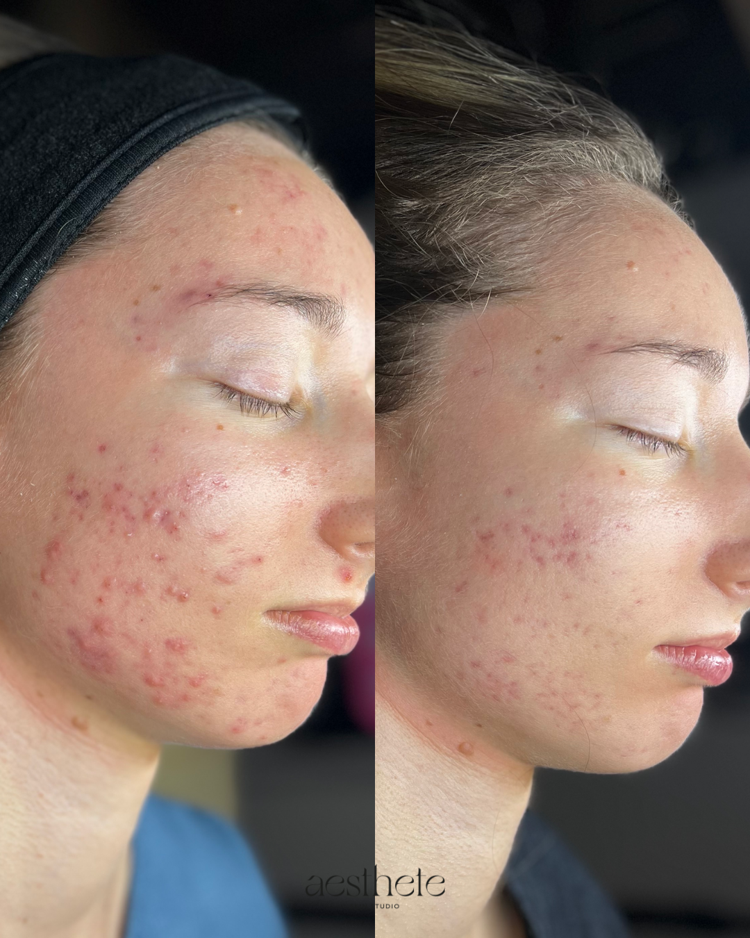 WEEK 5 FRIDAY (2)