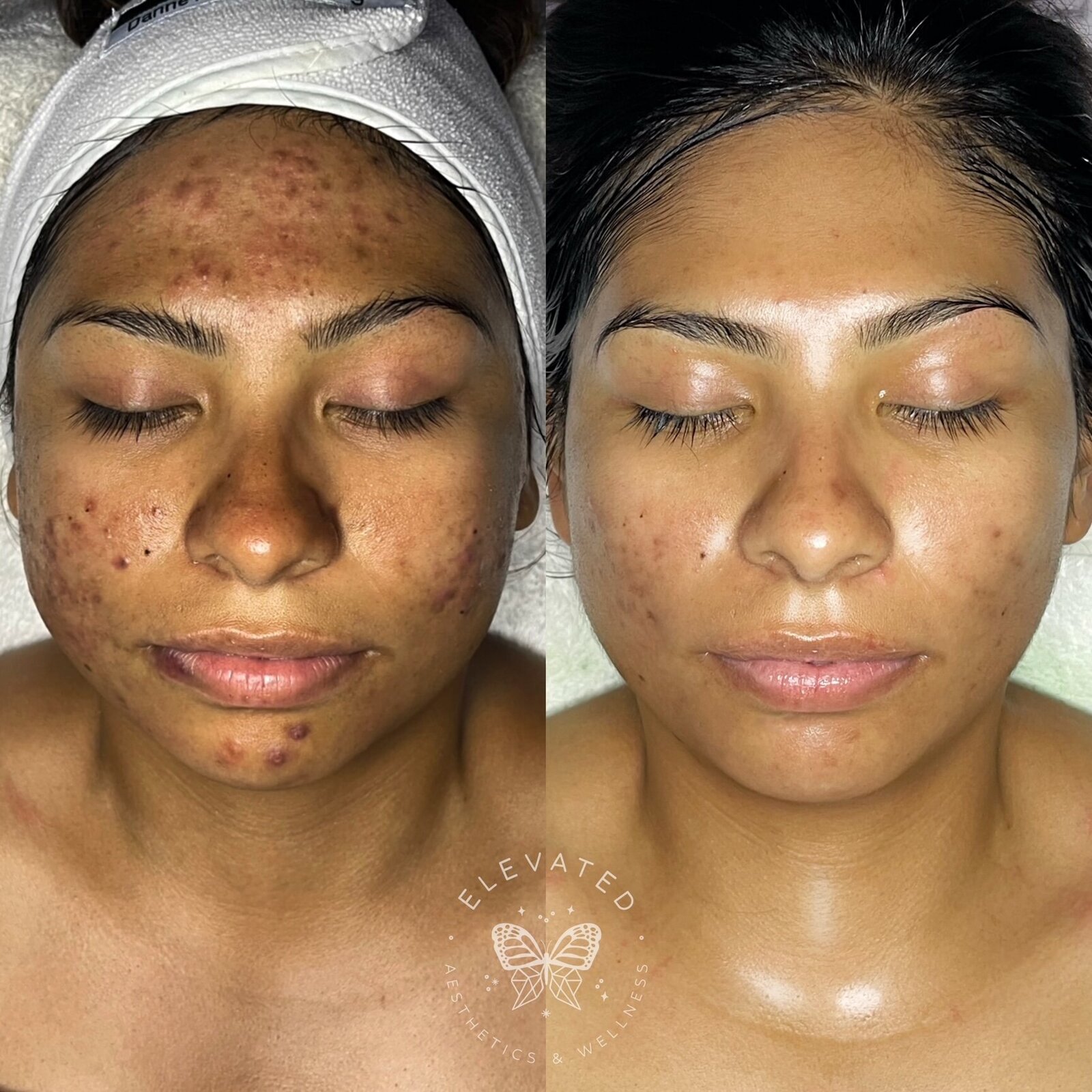 Facetune_20-01-2023-16-35-41