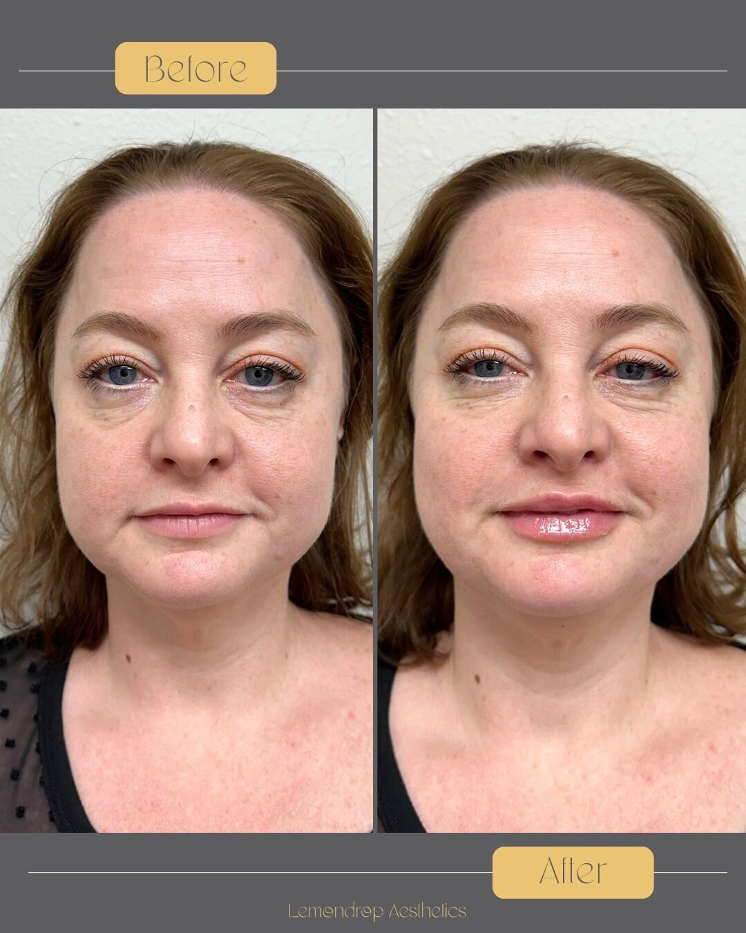 FULL FACE