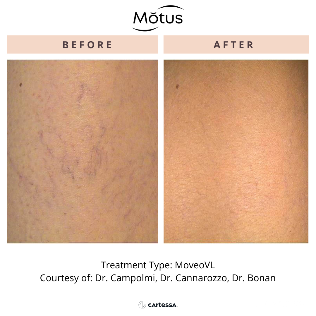 Motus3168970869123