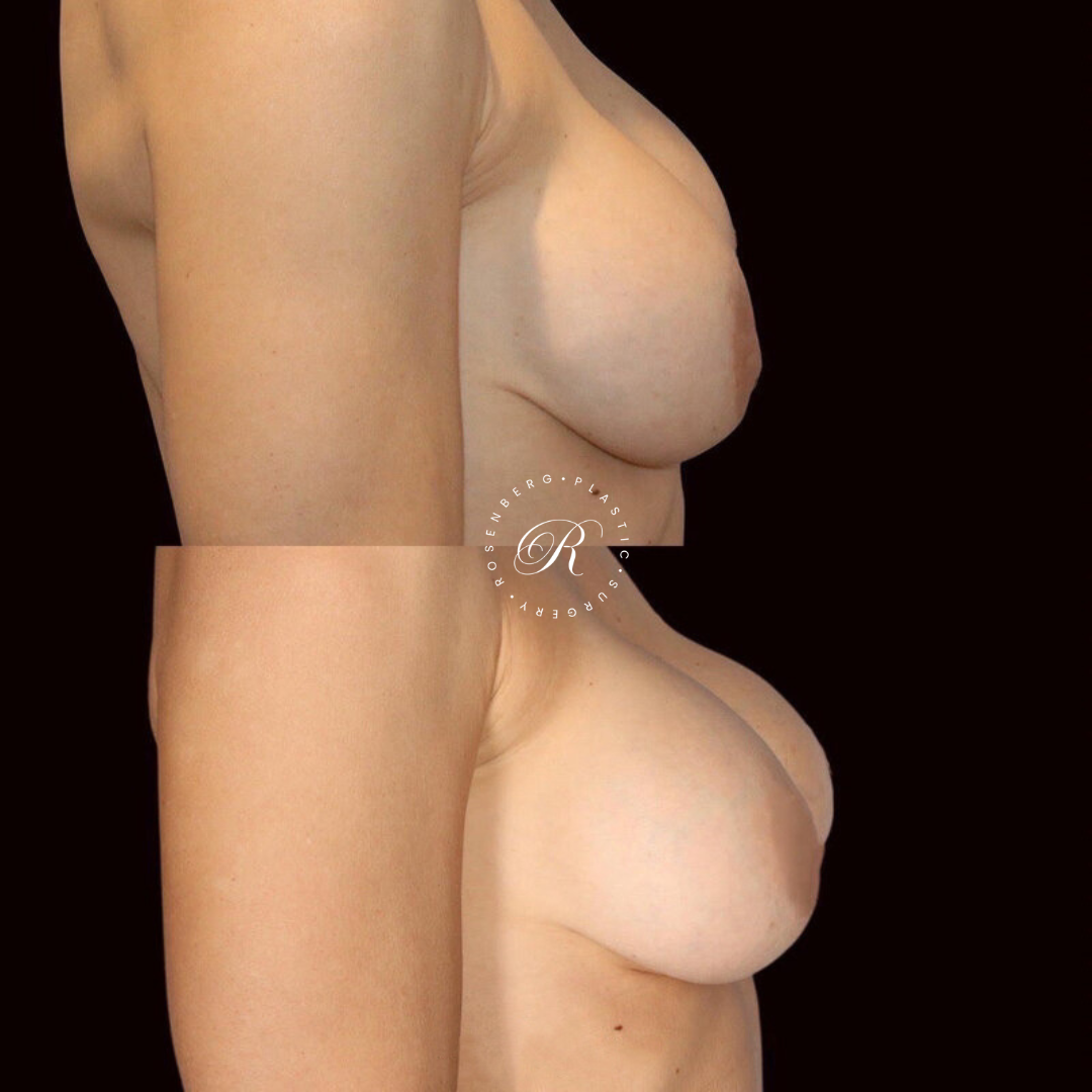 Copy of Template for Rosenberg Plastic Surgery B.zip - 13