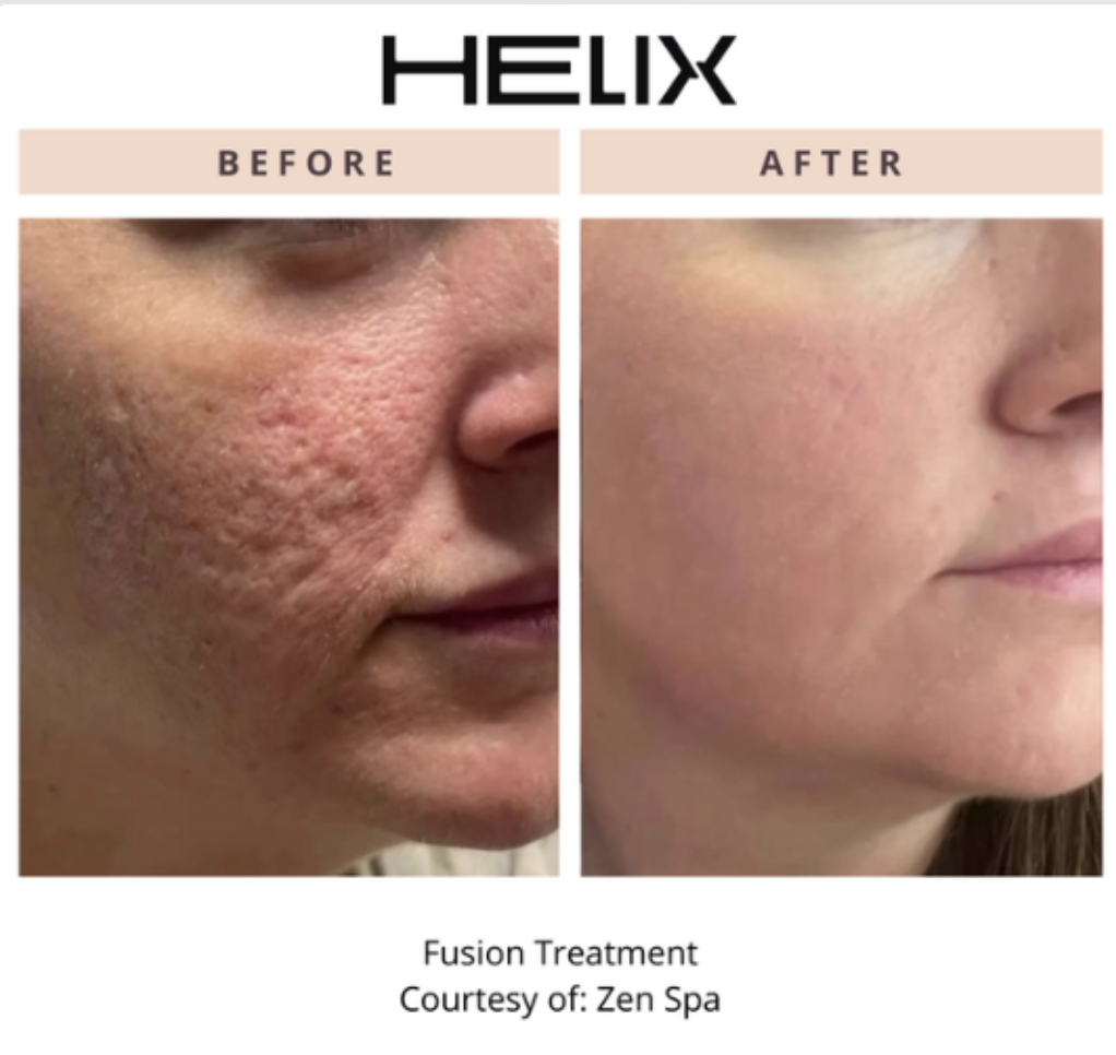 Client receiving honest aesthetic advice from Dr. Syed during pre-treatment consultation