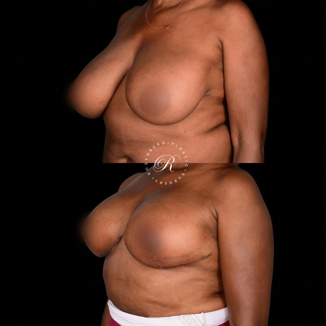 Copy of Template for Rosenberg Plastic Surgery B.zip - 27